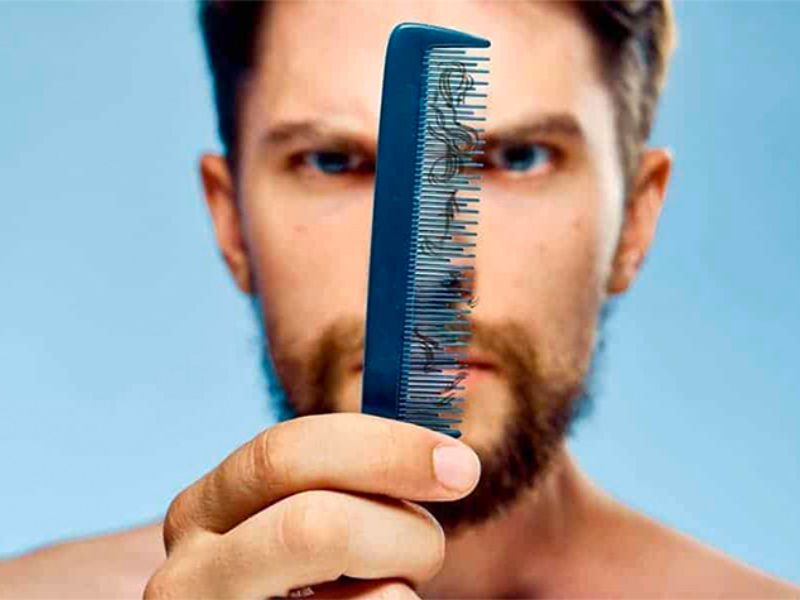 Haaruitval bij mannen: waarom word je kaal? - Blog | Confident Haarzorg
