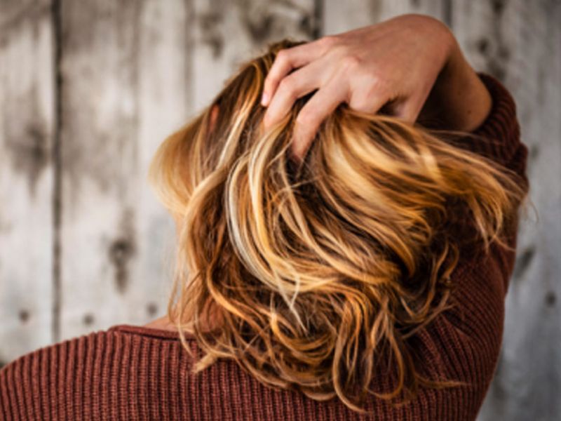 De vervelende gevolgen van een droge hoofdhuid: hoe het te behandelen en te voorkomen