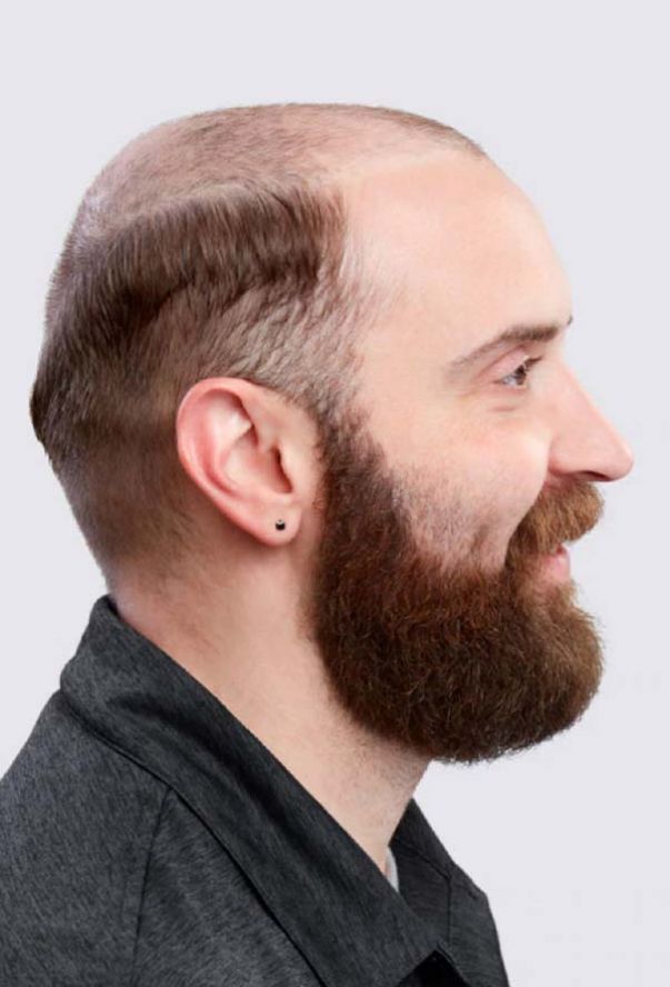 Haarstukken voor mannen Clearance