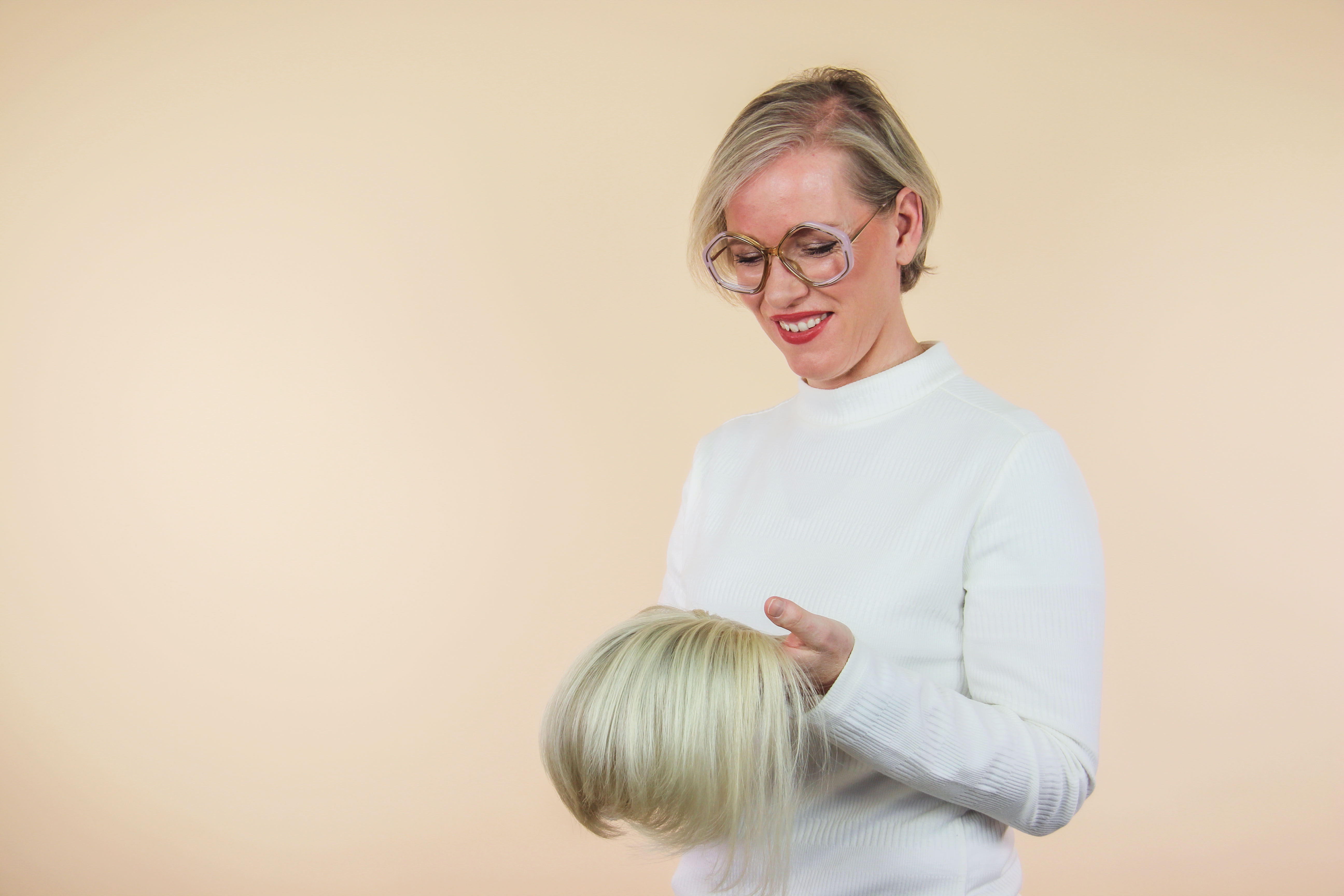 Haaruitval door alopecia