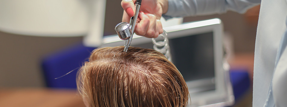 behandeling haarverlies behandeling haarverlies
