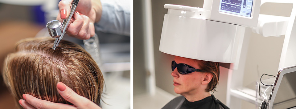 haarlaser therapie Confident Haarzorg