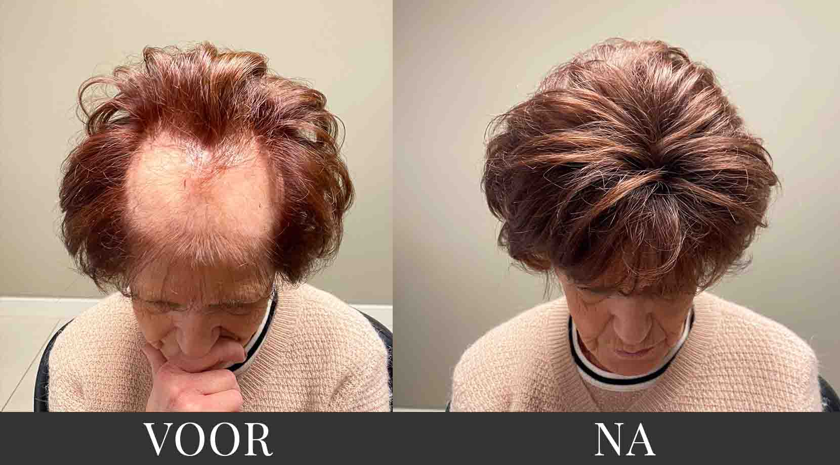 dames haarstuk voor en na