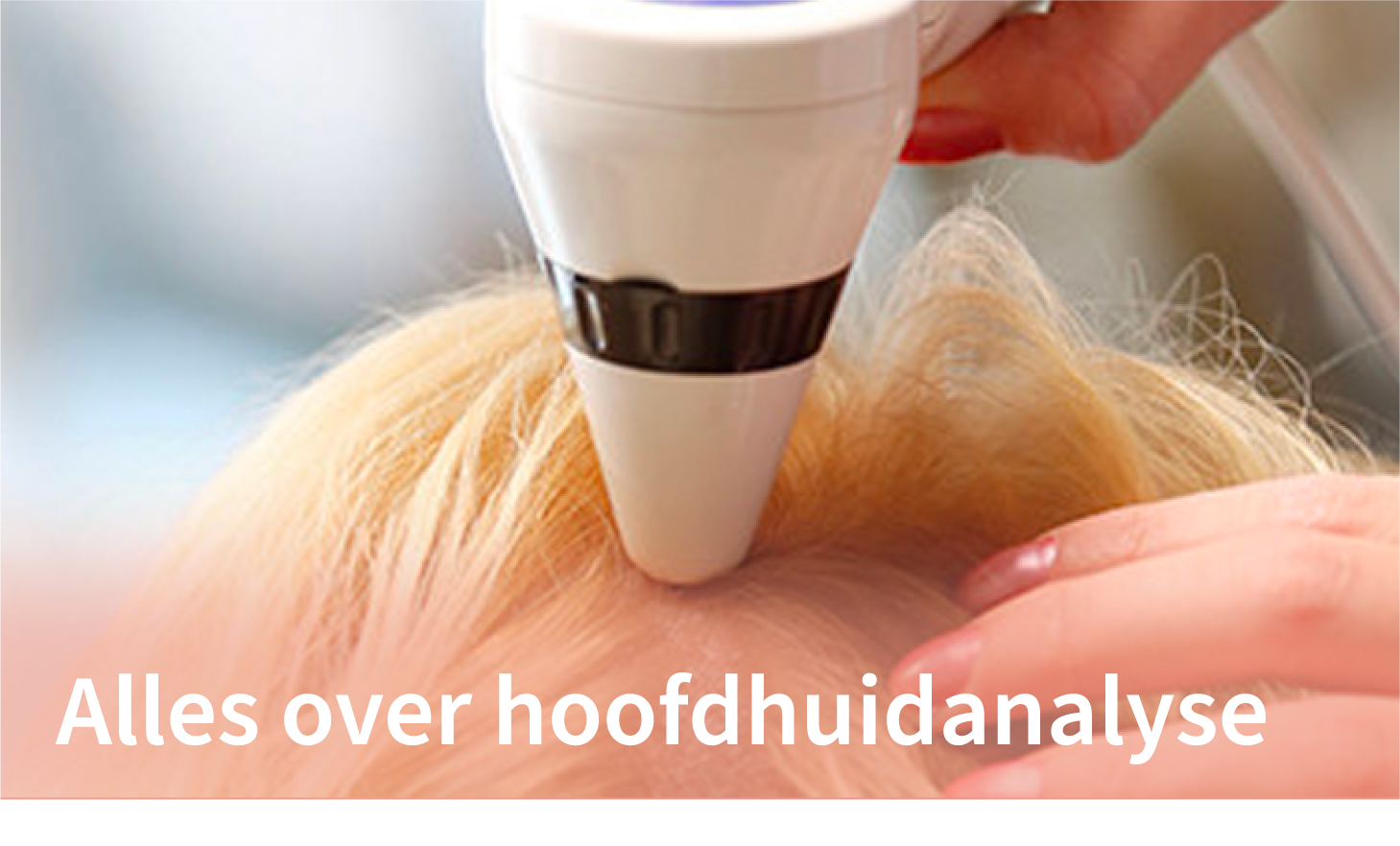 illustratie van hoofdhuidanalyse bij haaruitval mannen