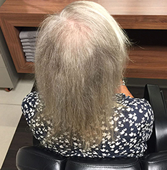 Dun haar vrouw